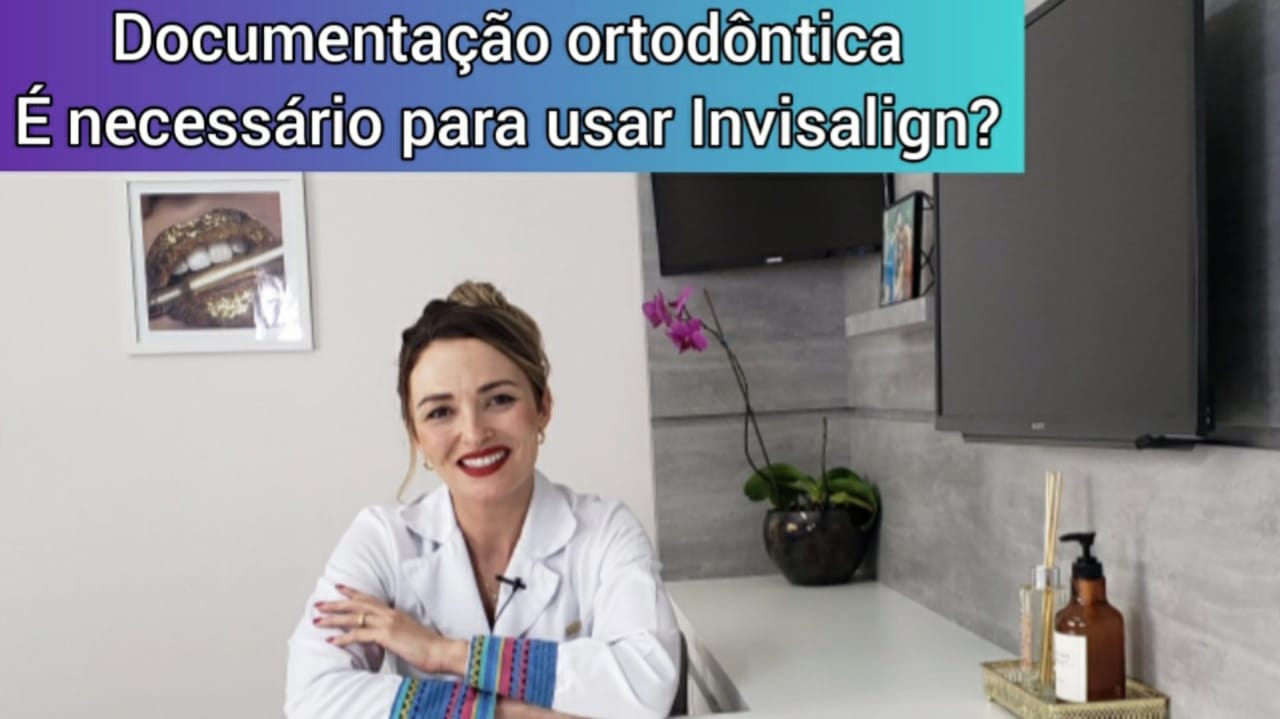 Read more about the article Documentação Ortodôntica é importante para usar Invisalign?